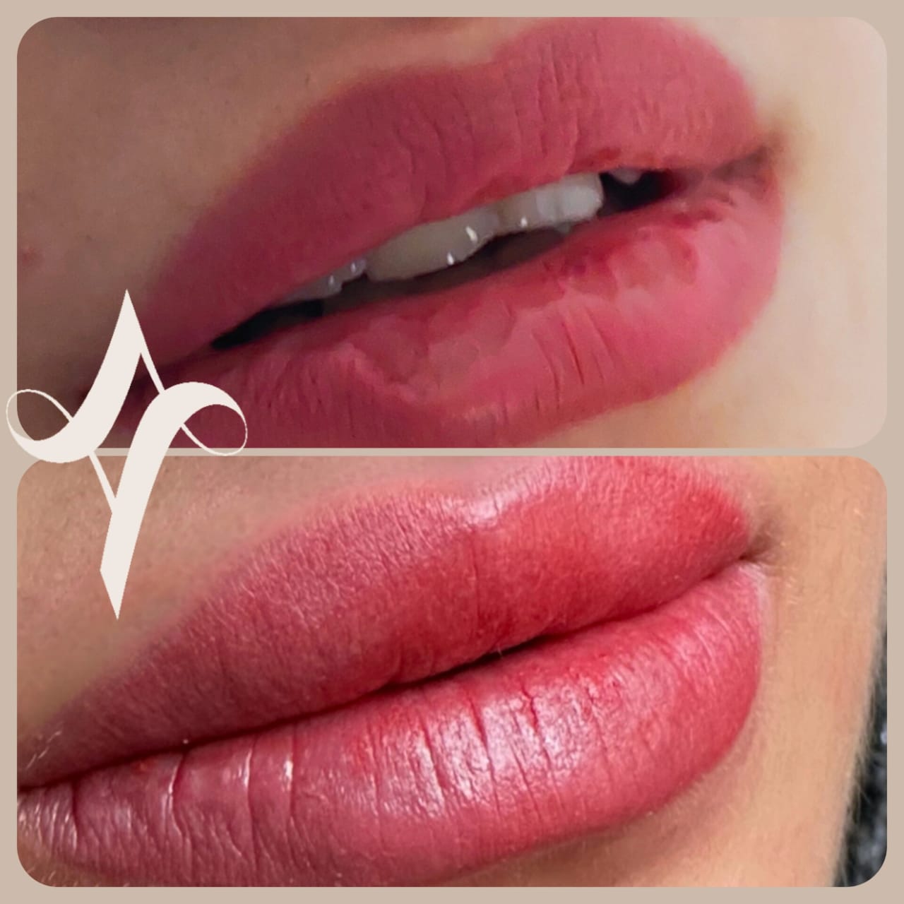 خدمات پاکسازی و درمان پوست یلدا اکبری در شیراز